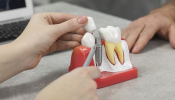 Innovations in Dental Implant Technology: What’s on the Horizon