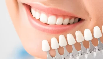 Dental Veneers for Gaps, Chips, and Cracked Teeth