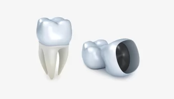 CEREC® Crowns: Benefits of One-Visit Crown Technology